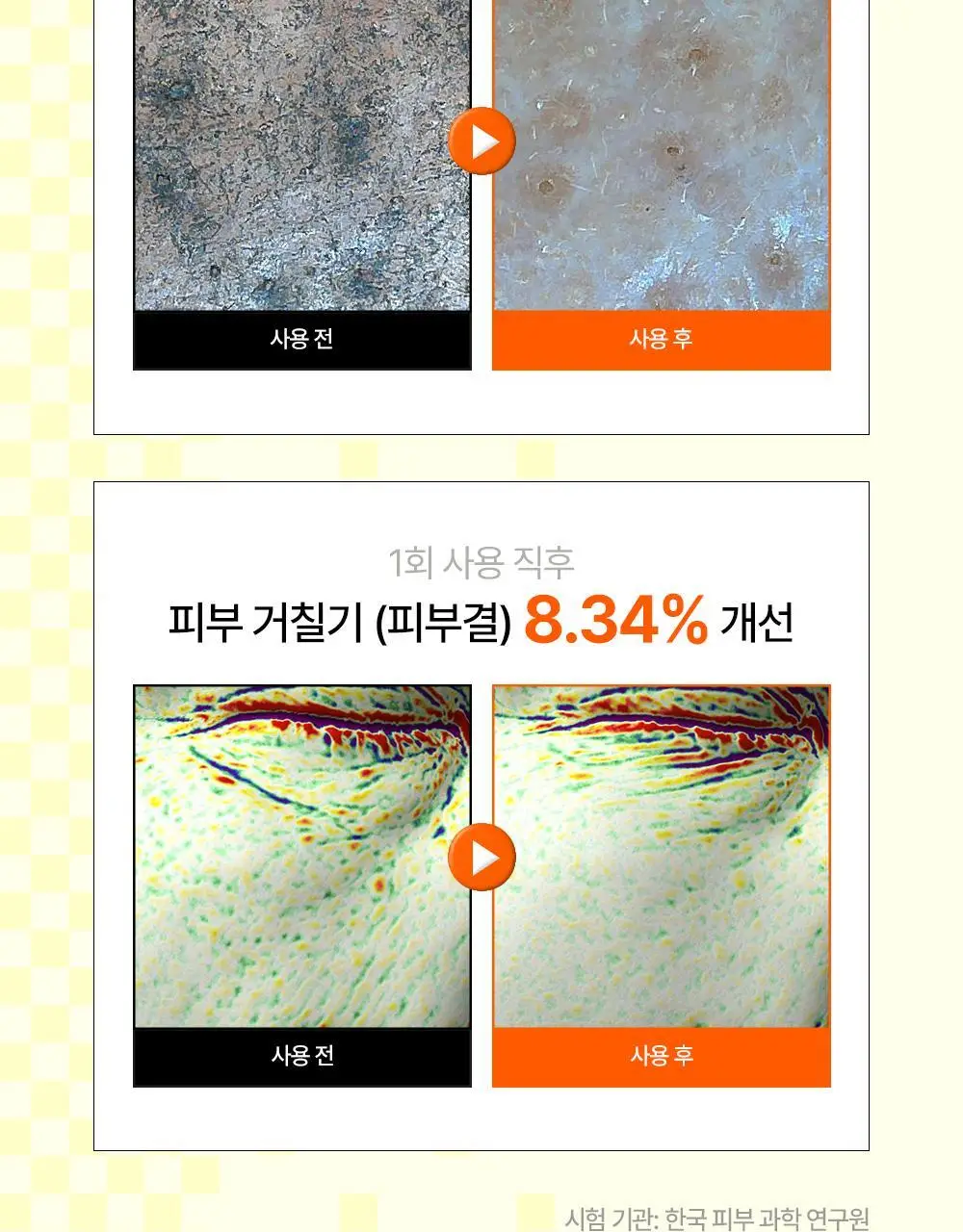 [온라인 단독] 파파레서피 블레미쉬 효소 파우더 클렌저 50g 더블기획 (+브러쉬+블레미쉬 크림 7ml) 상세페이지 13